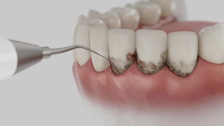 Trusted Wisdom Tooth Removal service in Golden Hills, CA - Dentist Open Now